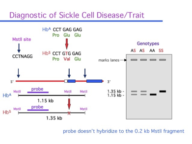 
							
								A graphic showing how sickle cell trait is identified through gel electrophoresis 
							
							